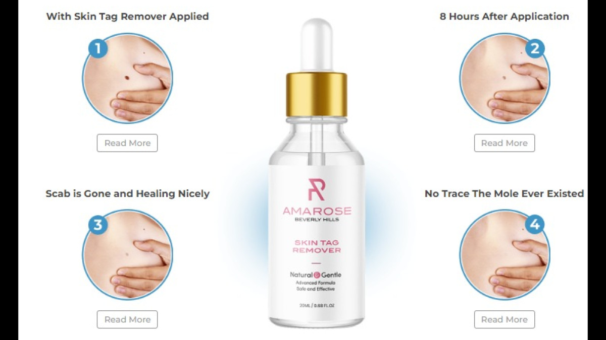 Amarose Skin Tag Remover Reviews - Is this work for Warts? Amarose Skin Tag Remover Scam or Legit? - Vimarsana News